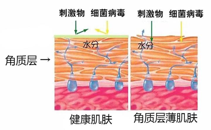 过度清洁角质层红肿,过度清洁后的皮肤怎么修复