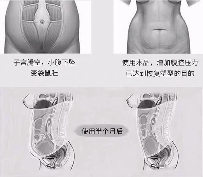 网红束腹带的效果,抖音爆款束腹带