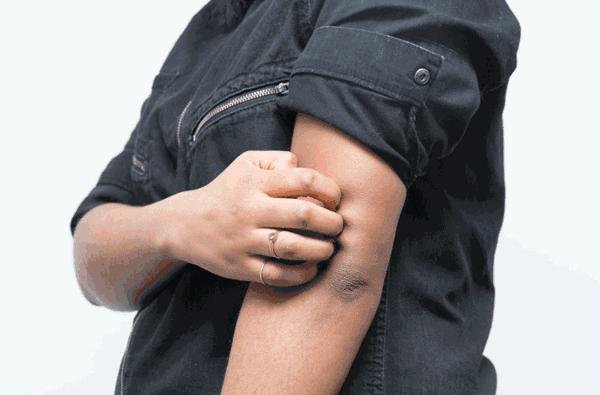 秋天身上干燥起皮屑,秋天皮肤干燥还需要做清洁吗