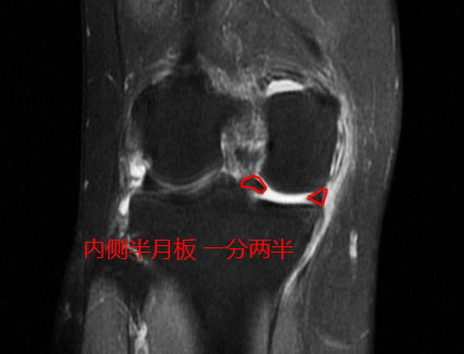 热爱舞蹈的老阿姨,热爱跳舞的阿姨