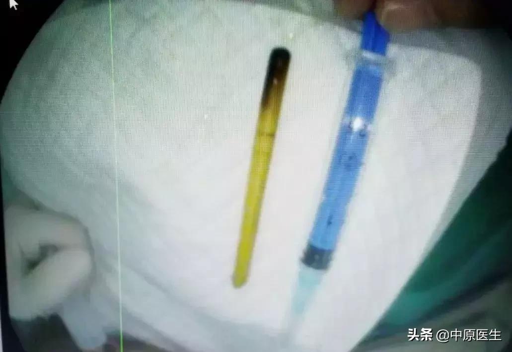 癫痫发作咬舌严重的怎么急救,癫痫咬舌头真的会死的吗