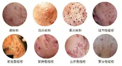 青春不再光芒依旧,青春不再青春痘还在的下一句