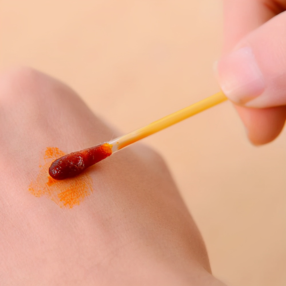 你见过哪些化学盲？你家用强酸处理伤口吗？