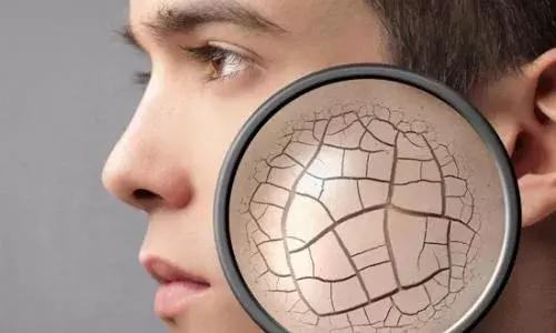 换季皮肤干起皮急救方法,换季皮肤干痒怎么修复