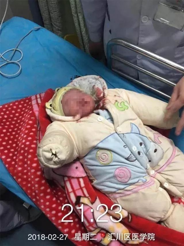 被老鼠咬伤要打狂犬疫苗吗,被老鼠咬伤后要不要打狂犬疫苗