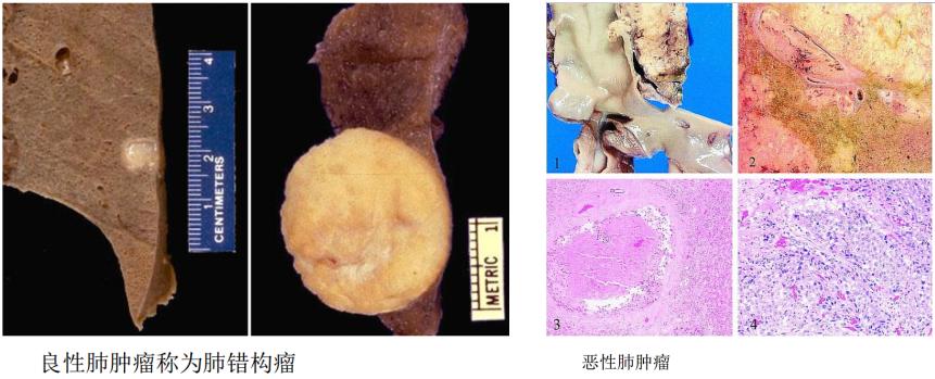 显微镜下的万花世界——走进病理学