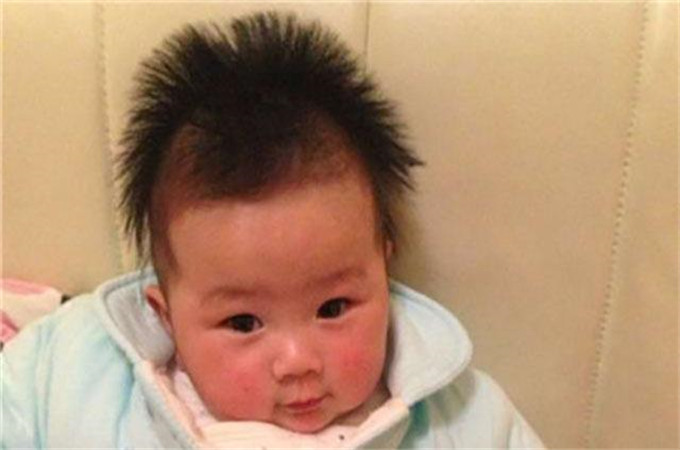 孩子的头发竖着长是怎么回事,孩子头发长有什么影响嘛