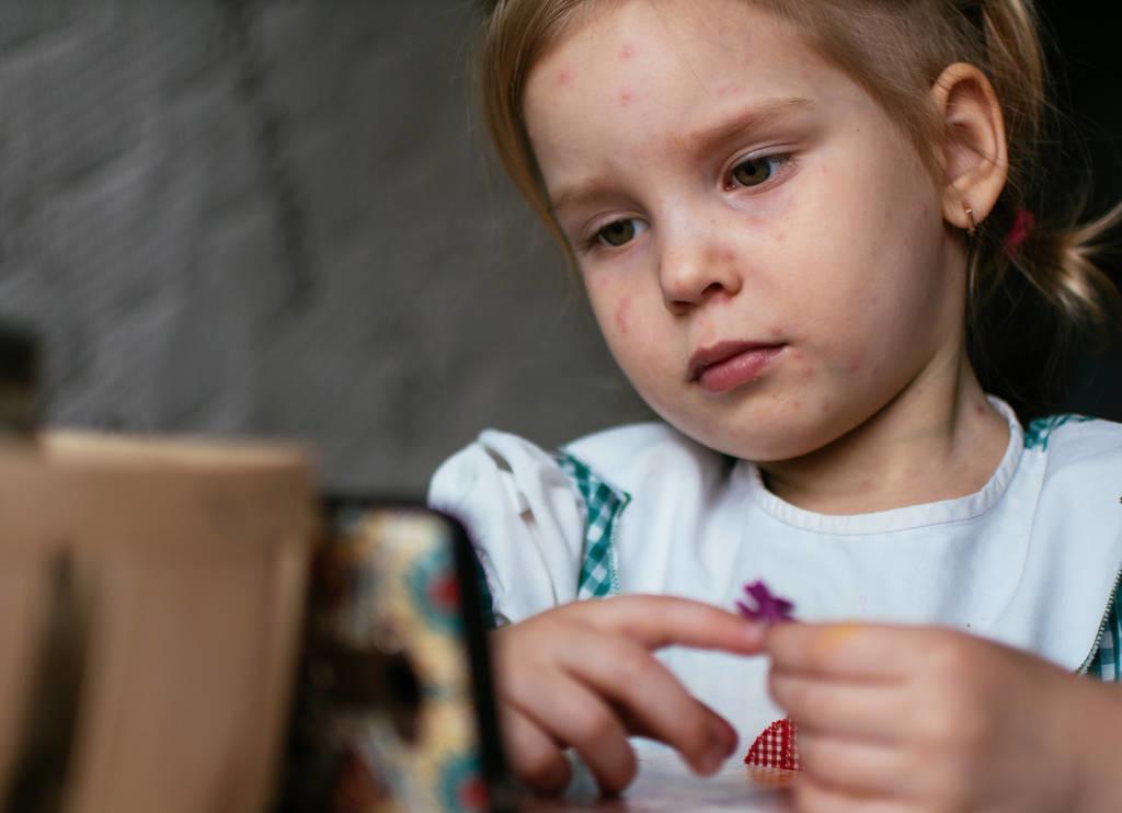 带状疱疹后神经痛的最佳治疗办法,带状疱疹性神经痛鉴别诊断