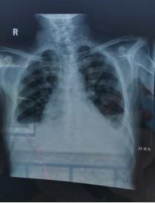 疫路风雨,街道工作者催人泪下防控疫情