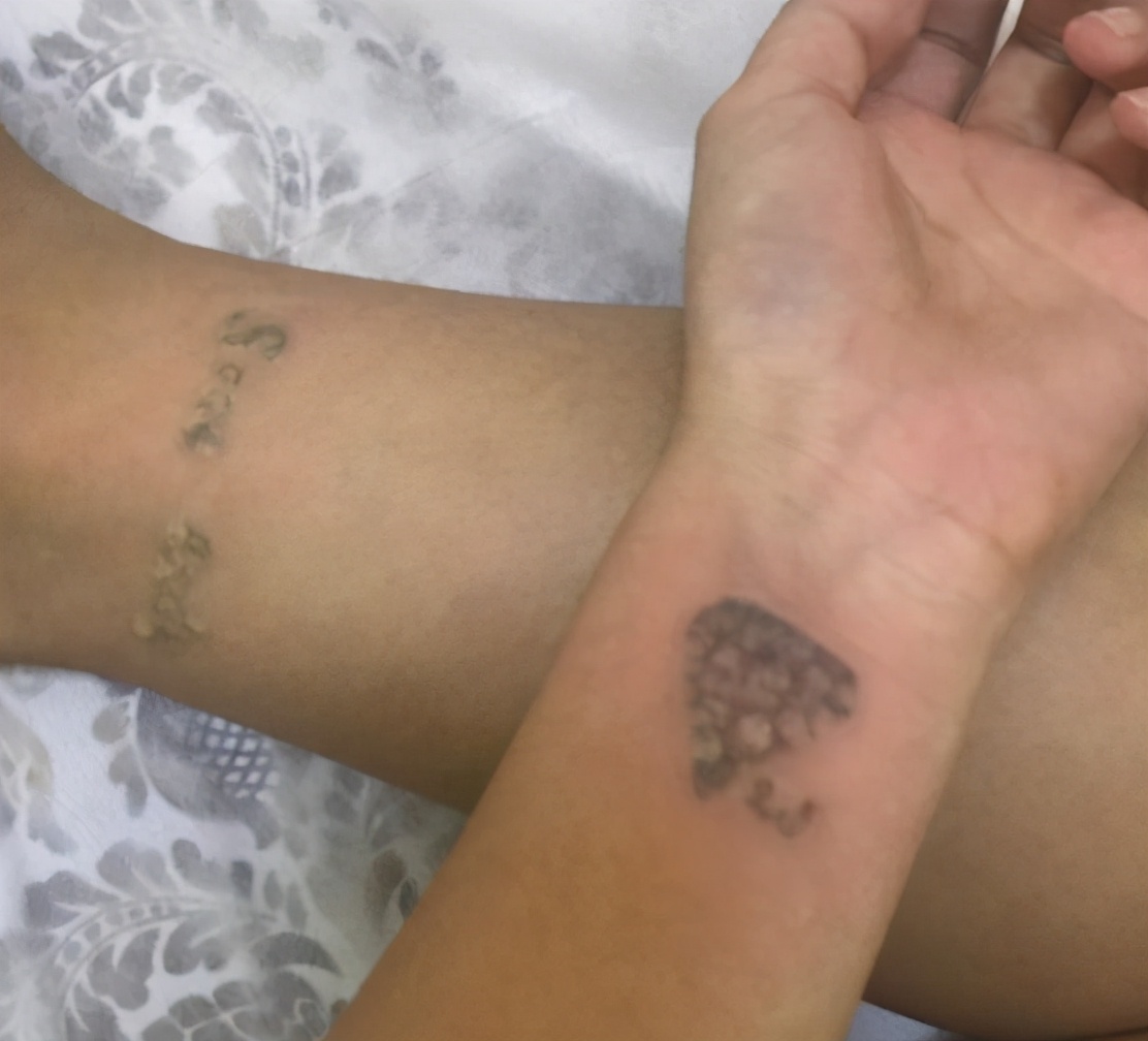 自己洗纹身最好的方法不留疤,洗纹身最好的方法不留疤多少钱