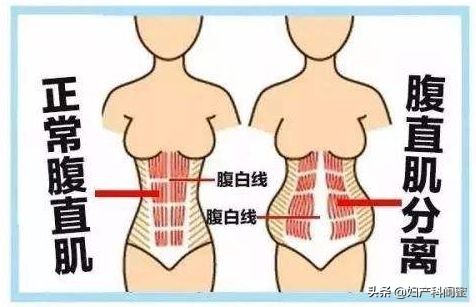 产后能恢复到少女时期的紧致,产后恢复的7条建议