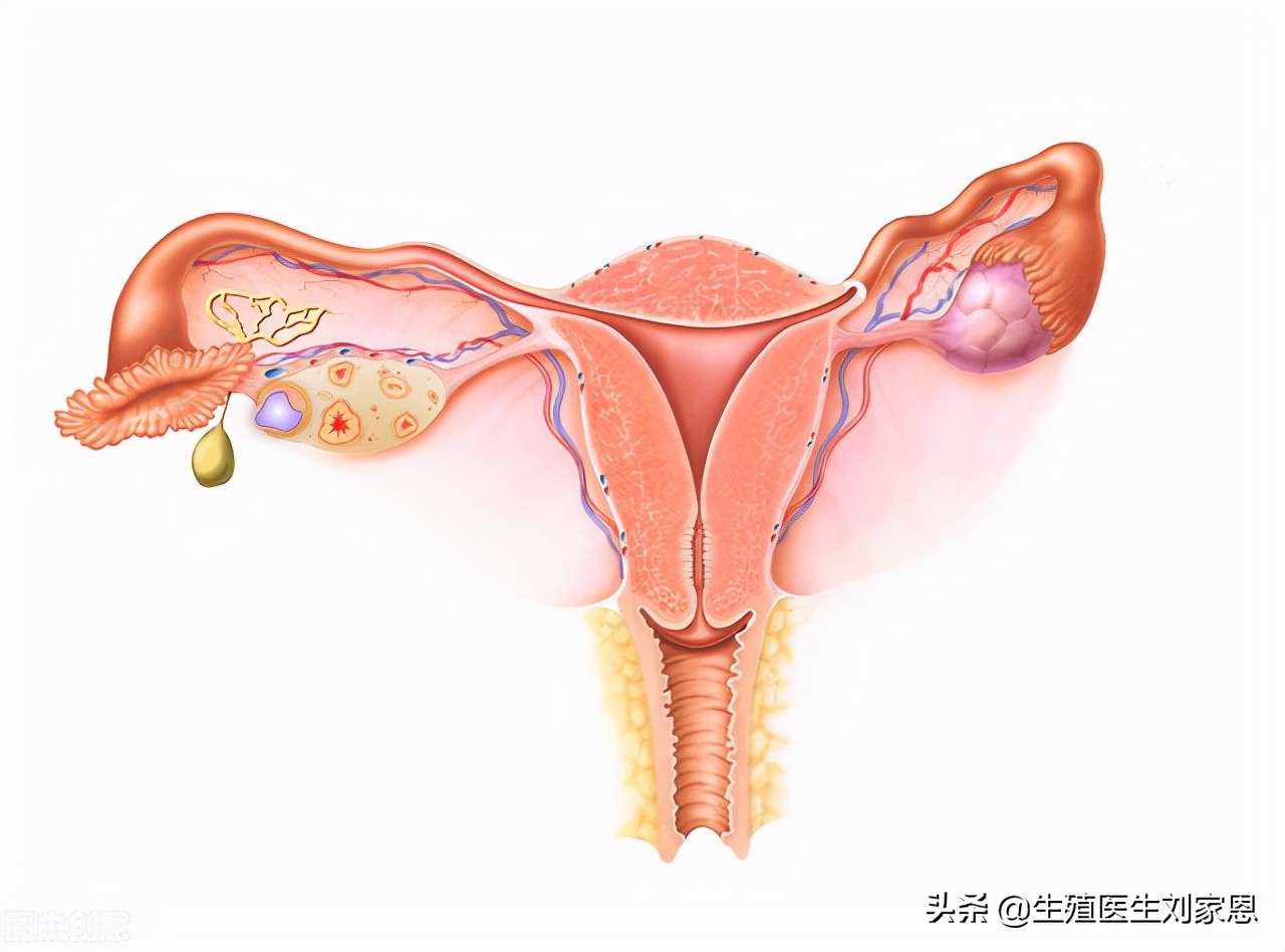 卵巢储备功能下降如何备孕,卵巢储备功能低备孕做什么运动