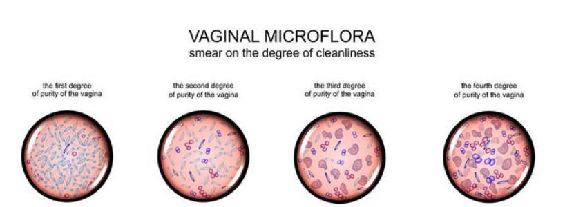 临床医生来不及和你解释的5大Y道炎误区，都在这里了