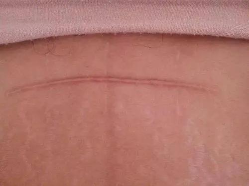 第25课主要内容,孕多少周最适合剖宫产