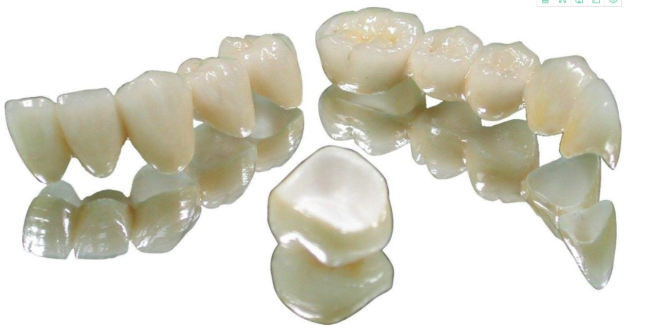 美牙冠改善龅牙,美牙冠可以修复缝隙吗