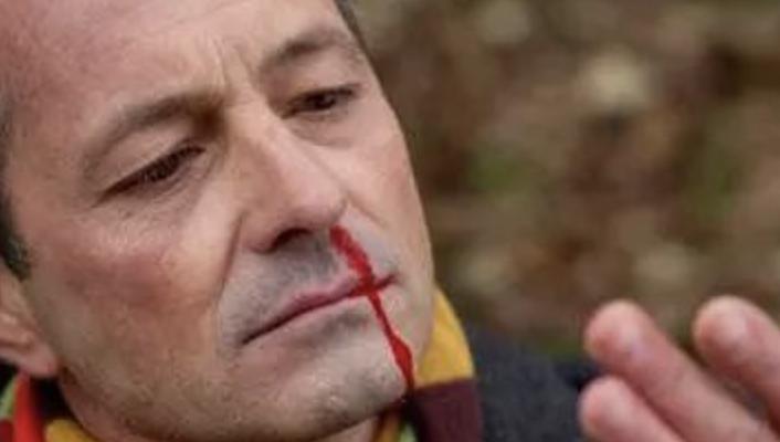 脑血栓前兆的6大信号,脑血栓前兆的12个信号