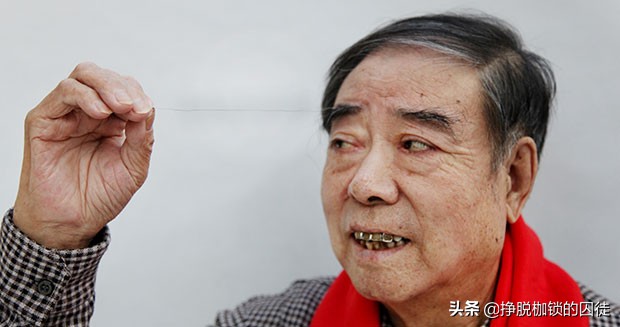 人为什么会长一根特别长的白眉毛,人长的眉毛与寿命有关吗