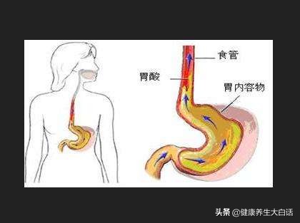 胃烧心反酸消化不好应吃哪些食物,吃淀粉类食物胃酸烧心是怎么回事