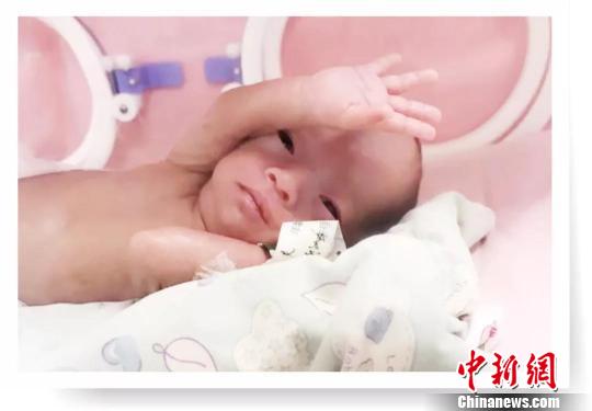 四川成都双胞胎两姐妹,双胞胎罕见病成长