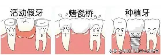 为什么镶完假牙以后有口臭,为什么镶牙之后感觉牙齿酸软痛