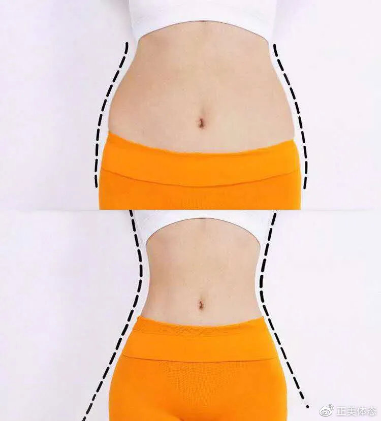 胯宽腰细怎么改善,胯宽骨盆修复管用吗