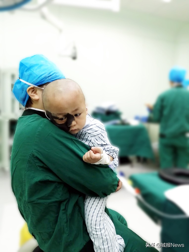 巨痣宝宝治疗费用,巨痣男童