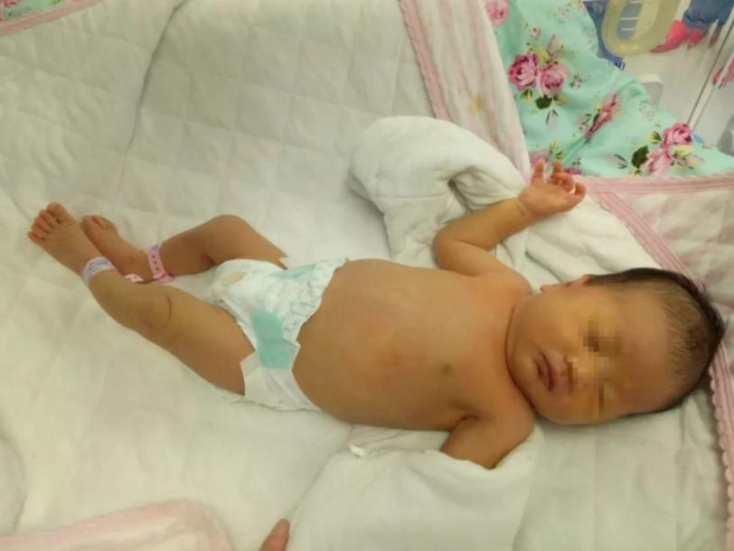 孩子背上长出“怪毛”,妈妈直接薅断,不料把娃薅进了ICU