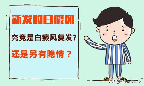 突发性白癜风治好了还会复发吗,白癜风好了一个月了没有症状