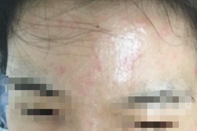 视黄醇a醇适合什么肤质,视黄醇跟a醇精华区别