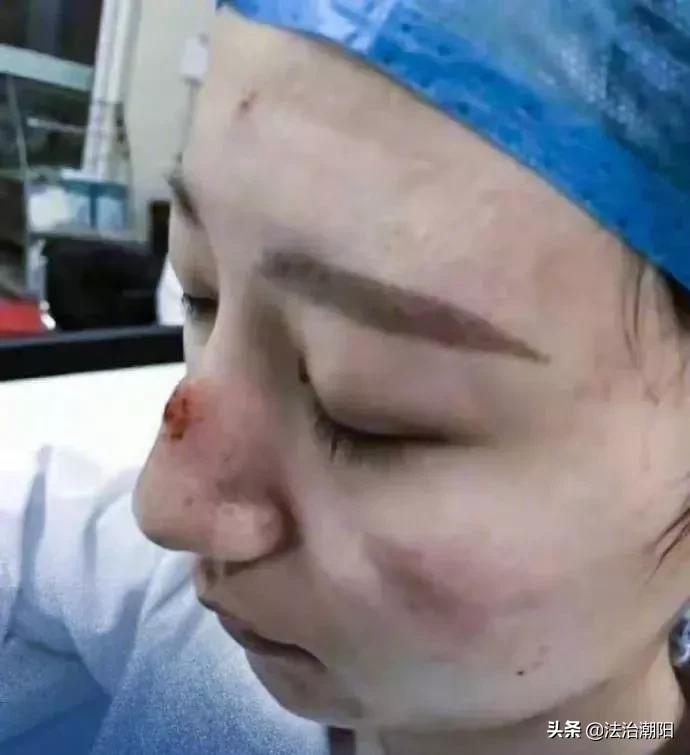 口罩把脸勒破,口罩把耳朵勒烂了怎么办