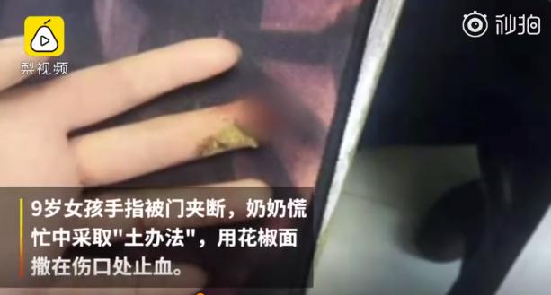 这些急救方式千万别学,牢记这3个急救方法