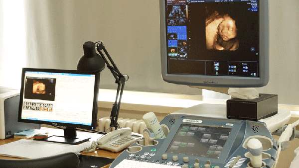 四维彩超对胎宝宝有影响吗,四维彩超胎宝不配合