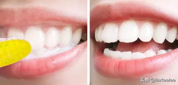 最好用的牙膏排行榜前十名,选哪个牌子的牙膏最安全好用