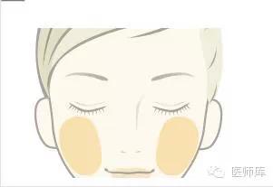 什么是线雕图片,什么是线雕线雕效果怎么样