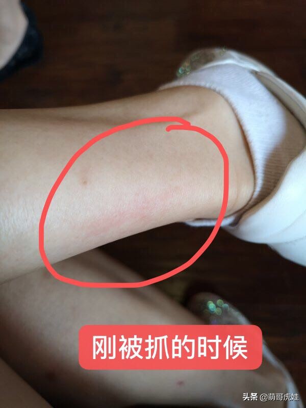 巨型贵宾遇到陌生的人乱咬怎么办,客人被猫抓伤打疫苗