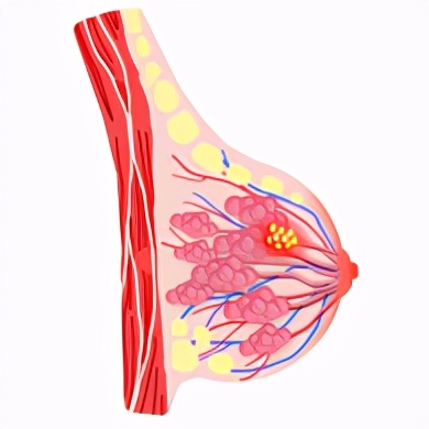6种最常见癌症的早期症状,六种常见的癌有哪些