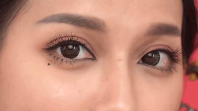 祛除眼袋的小妙招红霉素软膏,男生怎么祛除眼袋最快最有效