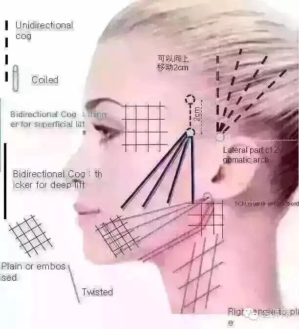 什么是线雕图片,什么是线雕线雕效果怎么样