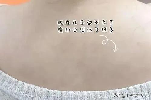 床单不洗螨虫成千上万,床单30天不洗竟螨虫成堆