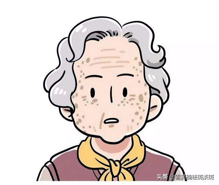 去斑点淡斑最有效方法,去斑点的最好方法最快最有效果