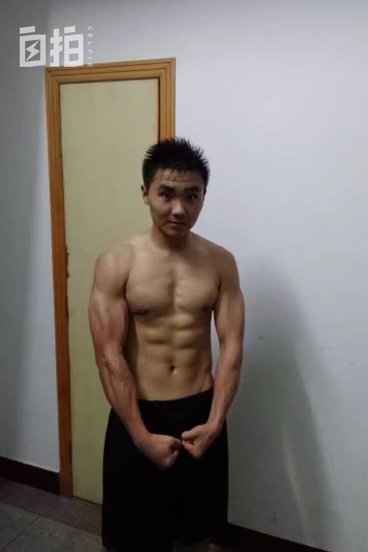 我27岁，在最幸福的时候遭意外，与死神擦肩而过