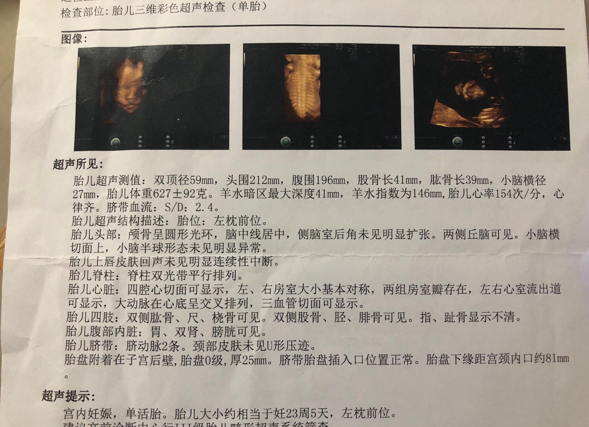 妇产科专家讲解孕酮,产科医生深度解析