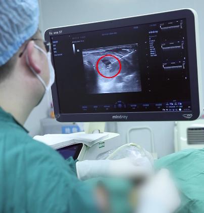 真实案例：甲状腺全切术后不仅留下“自杀式”切口，又出现感染