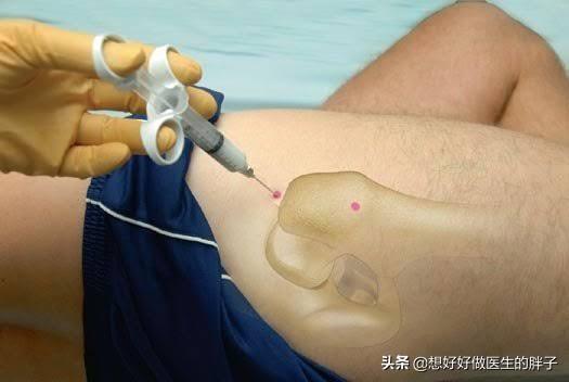 髋关节疼痛两腿不一样长如何康复,左大腿髋关节突然疼痛是什么原因