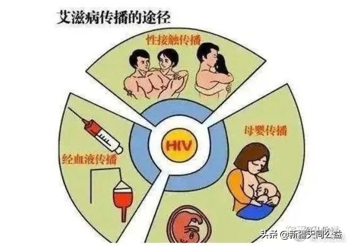 少年染艾滋病,13岁少年染上艾滋病