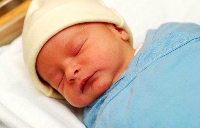 新生儿黄到什么程度有黄疸,出生10多天的宝宝黄疸是什么原因