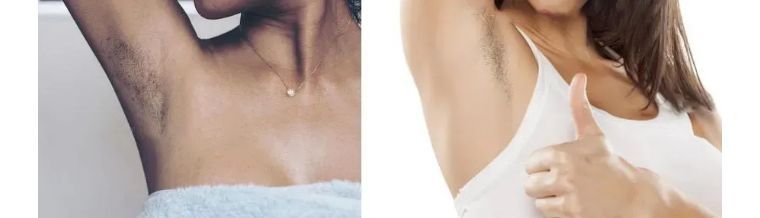 j-style脱毛仪怎么用,j-style脱毛仪怎样