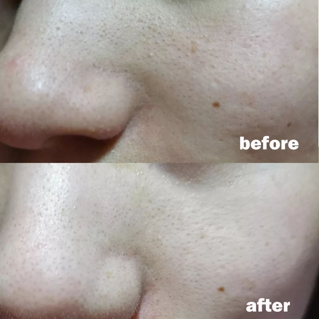 清洁面膜测评,清洁面膜测评打假