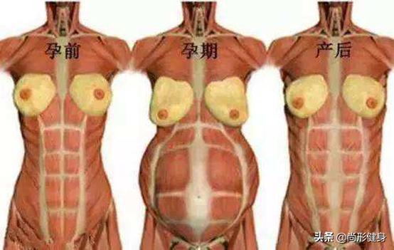 产后康复没有效果,产后修复不修复危害