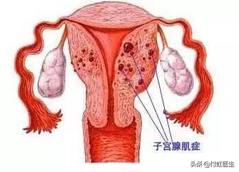 宫内避孕环真的可以避孕吗,又能避孕又能调经的药